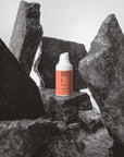 Acne vlekverzorging